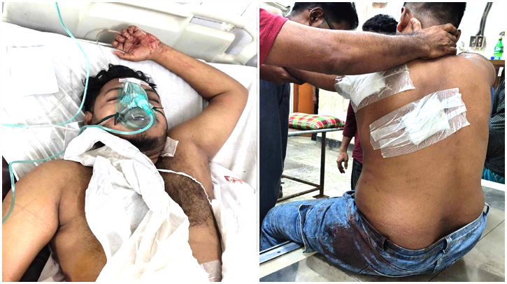 ফতুল্লায় দুই যুবককে কুপিয়ে হত্যার চেষ্টা, গ্রেপ্তার ১ ফতুল্লায় দুই যুবককে কুপিয়ে হত্যার চেষ্টা, গ্রেপ্তার ১