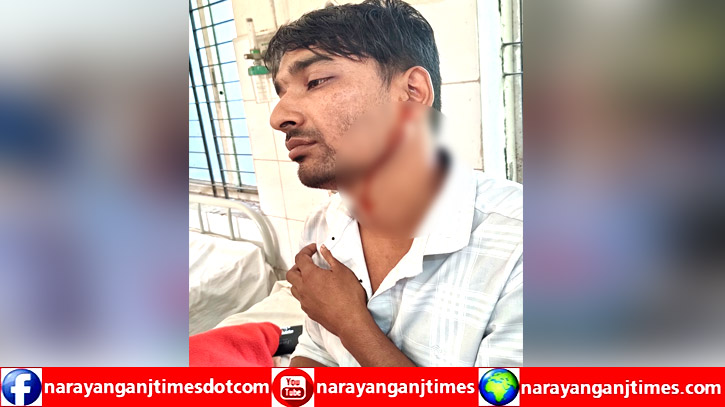 সোনারগাঁয়ে সালিশ বিচার থেকে বাড়ি ফেরার পথে হামলা, আহত ২ সোনারগাঁয়ে সালিশ বিচার থেকে বাড়ি ফেরার পথে হামলা, আহত ২