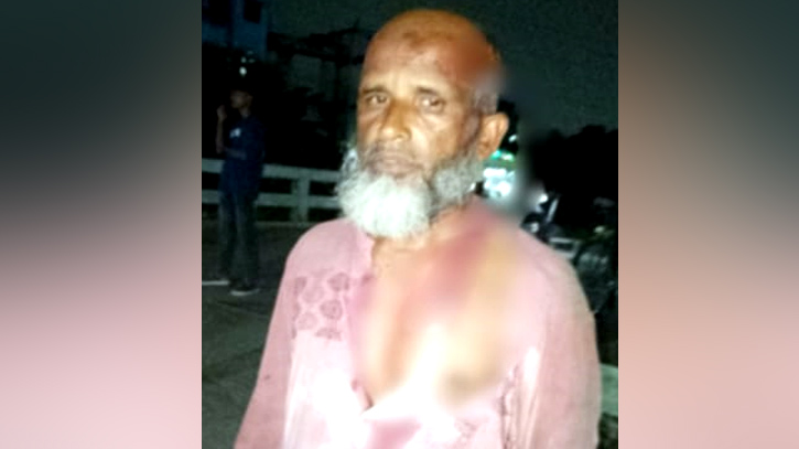 ফতুল্লায় হামলার শিকার জামায়াত নেতা, কুপিয়ে জখম