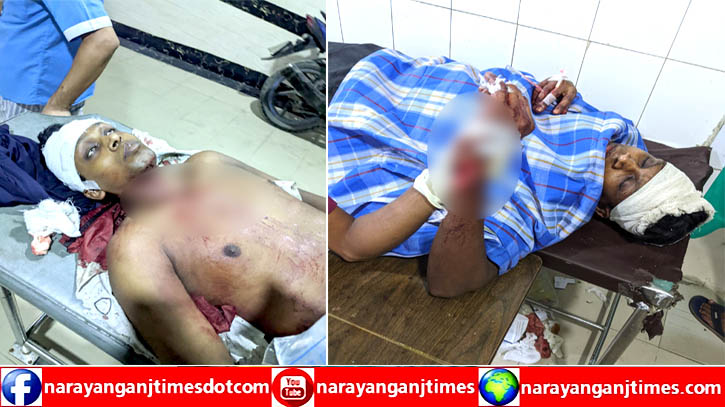 সোনারগাঁয়ে দুই ভাইকে কুপিয়ে হত্যা চেষ্টা, প্রতিপক্ষের দাবি ভিন্ন সোনারগাঁয়ে দুই ভাইকে কুপিয়ে হত্যা চেষ্টা, প্রতিপক্ষের দাবি ভিন্ন