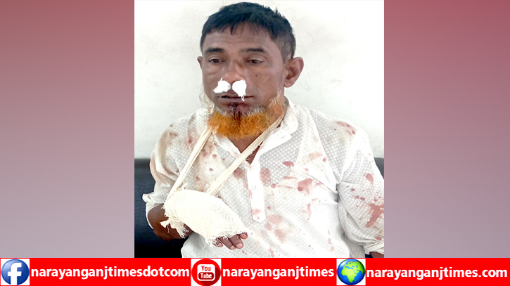 বন্দরে সন্ত্রাসী হামলায় বৃদ্ধ নজরুল আহত বন্দরে সন্ত্রাসী হামলায় বৃদ্ধ নজরুল আহত