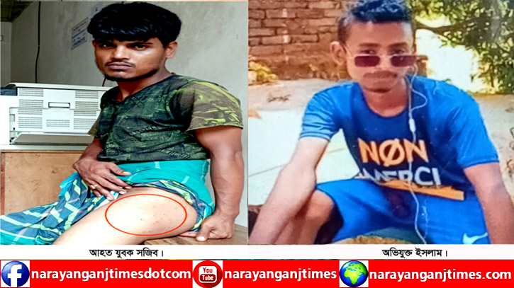 বন্দরে সন্ত্রাসী হামলায় টেটাবিদ্ধ হয়ে যুবক আহত বন্দরে সন্ত্রাসী হামলায় টেটাবিদ্ধ হয়ে যুবক আহত