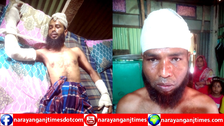 বন্দরে তুচ্ছ ঘটনাকে কেন্দ্র করে সন্ত্রাসী হামলায় আহত ২ বন্দরে তুচ্ছ ঘটনাকে কেন্দ্র করে সন্ত্রাসী হামলায় আহত ২