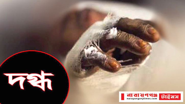 দেভভোগে গ্যাসের লিকেজ থেকে বিস্ফোরণে অন্ত:সত্ত্বা নারী দগ্ধ দেভভোগে গ্যাসের লিকেজ থেকে বিস্ফোরণে অন্ত:সত্ত্বা নারী দগ্ধ