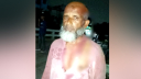 ফতুল্লায় হামলার শিকার জামায়াত নেতা, কুপিয়ে জখম