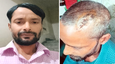 ছাত্র আন্দোলনে গুলিতে আহত জাহাঙ্গীরের খবর নেয়নি কেউ