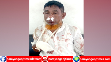 বন্দরে সন্ত্রাসী হামলায় বৃদ্ধ নজরুল আহত