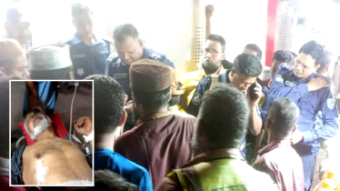 ফতুল্লায় ব্যবসায়ীকে লক্ষ্য করে দূর্বৃত্তদের গুলি