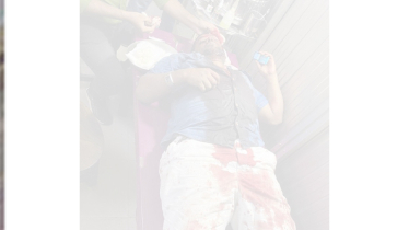 ফতুল্লায় যুবককে কুপিয়ে হত্যার চেষ্টা, আটক  ৩