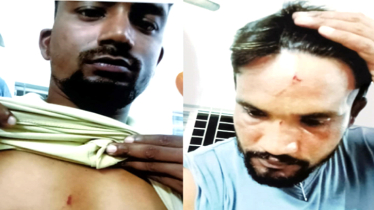 বন্দরে সিটিটোল আদায়কে কেন্দ্র করে সন্ত্রাসী হামলা, আহত ৫