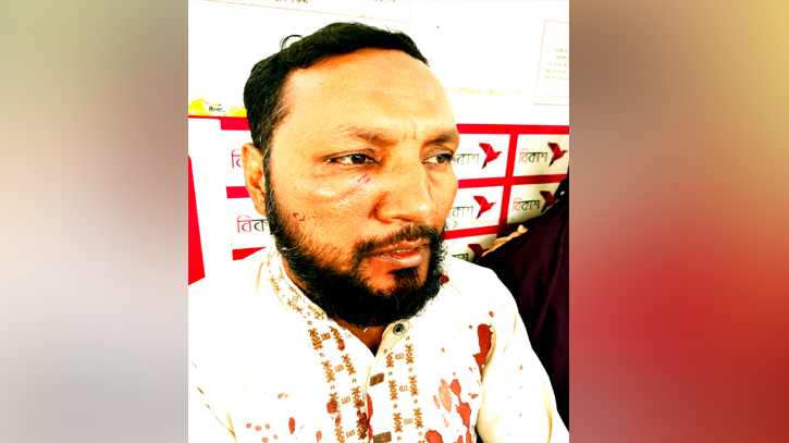 বন্দরে সন্ত্রাসী হামলায় মিজানুর মেম্বার আহত, নগদ টাকা লুট বন্দরে সন্ত্রাসী হামলায় মিজানুর মেম্বার আহত, নগদ টাকা লুট