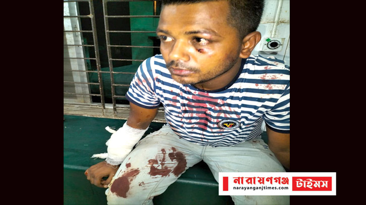 বন্দরে ছাত্রলীগ কর্মীকে কুপিয়ে জখম, গ্রেপ্তার ১ বন্দরে ছাত্রলীগ কর্মীকে কুপিয়ে জখম, গ্রেপ্তার ১