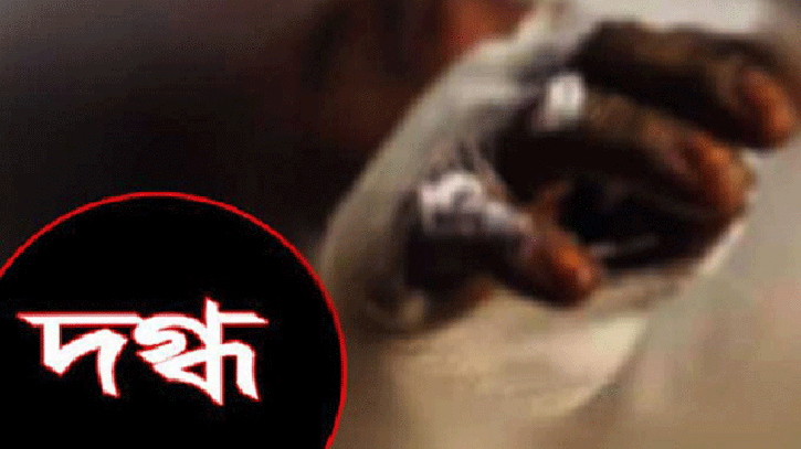 আড়াইহাজারে গার্মেন্ট শ্রমিক দগ্ধ আড়াইহাজারে গার্মেন্ট শ্রমিক দগ্ধ
