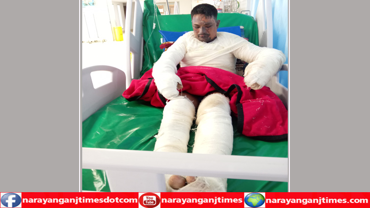 অবৈধ গ্যাসলাইন বিস্ফোরণে দ্বগ্ধ যুবক মৃত্যুর সঙ্গে পাঞ্জা লড়ছে অবৈধ গ্যাসলাইন বিস্ফোরণে দ্বগ্ধ যুবক মৃত্যুর সঙ্গে পাঞ্জা লড়ছে