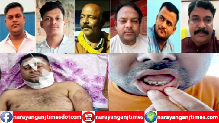 সিদ্ধিরগঞ্জে পুলিশের অভিযানকে কেন্দ্র করে যুবকের উপর হামলার মামলায় আতংক সিদ্ধিরগঞ্জে পুলিশের অভিযানকে কেন্দ্র করে যুবকের উপর হামলার মামলায় আতংক