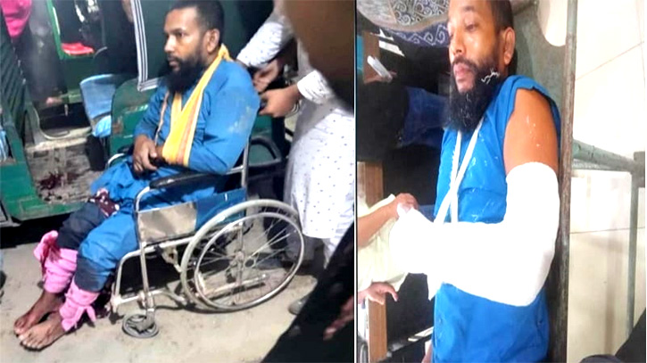 সোনারগাঁয়ে চাঁদা না পেয়ে ওষুধ ব্যবসায়ীকে হাত-পা ভেঙ্গে কুপিয়ে জখম সোনারগাঁয়ে চাঁদা না পেয়ে ওষুধ ব্যবসায়ীকে হাত-পা ভেঙ্গে কুপিয়ে জখম