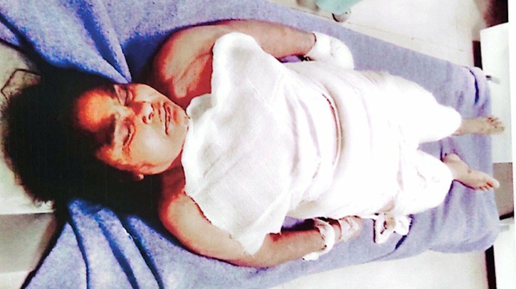 ফতুল্লায় অগ্নিদগ্ধ হয়ে নারীর মৃত্যু