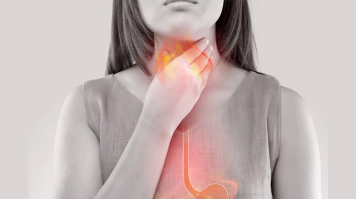 গলা-বুক জ্বালাপোড়া: কারণ, করণীয় ও চিকিৎসা