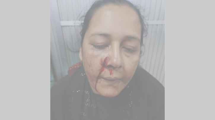 ফতুল্লায় গৃহবধূকে কুপিয়ে হত্যাচেষ্টা, এক সপ্তাহেও গ্রেফতার নেই