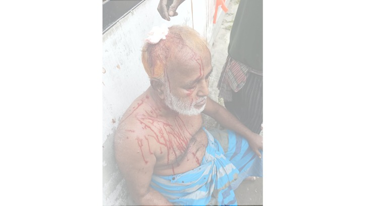 রাস্তা নিয়ে বিরোধের জেরে সিদ্ধিরগঞ্জে হামলায় নারীসহ আহত ৩