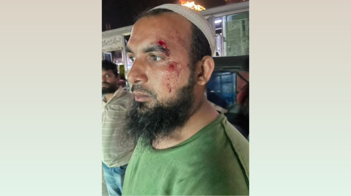 সোনারগাঁয়ে চাঁদা না দেয়ায় মাথা ফাটল ব্যবসায়ীর