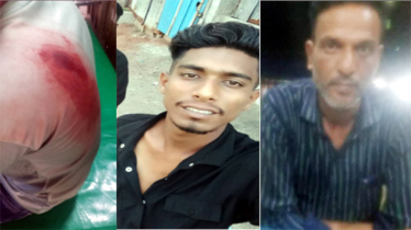 সেনাবাহিনী প্রজেক্টের মালামাল চুরিতে বাঁধা দেয়ায় যুবককে ছুরিকাঘাত