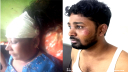 বন্দরে শ্বশুড় বাড়ির সন্ত্রাসী হামলায় মা ও ছেলে জখম  