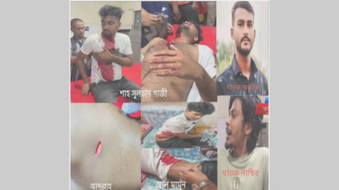 চরকিশোরগঞ্জে মাদক ব্যবসায়ীকে আটক করায় ৩জনকে কুপিয়ে জখম
