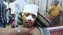 ফতুল্লায় জামায়াত নেতাকে কুপিয়ে জখম, গ্রেপ্তার হয়নি মূল অভিযুক্তরা ফতুল্লায় জামায়াত নেতাকে কুপিয়ে জখম, গ্রেপ্তার হয়নি মূল অভিযুক্তরা