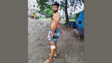 সিদ্ধিরগঞ্জে কৃষক দল নেতাকে কুপিয়ে জখম,  ৮০ হাজার টাকা ছিনিয়ে নেওয়ার অভিযোগ