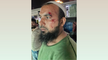 সোনারগাঁয়ে চাঁদা না দেয়ায় মাথা ফাটল ব্যবসায়ীর