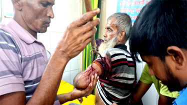আড়াইহাজারে তিনদল গ্রামবাসীর মধ্যে সংষর্ষ, টেঁটাবিদ্ধ সহ আহত ২০