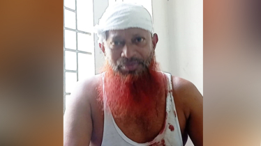 বন্দরে বাকি না দেওয়ায় মুদি দোকানীকে পিটিয়ে রক্তাক্ত জখম  