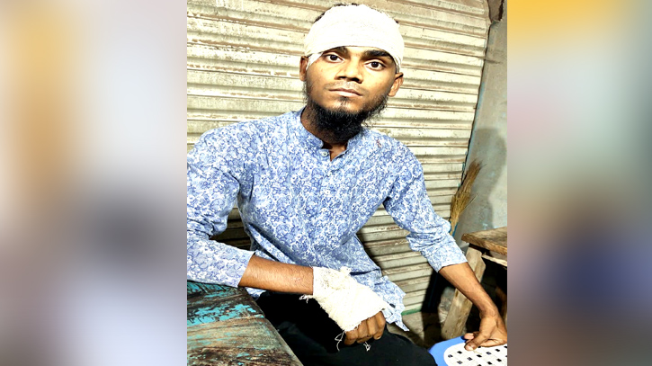 রূপগঞ্জে বাবা-ছেলেকে কুপিয়ে জখম, নগদ টাকা ও স্বর্ণালংকার লুট রূপগঞ্জে বাবা-ছেলেকে কুপিয়ে জখম, নগদ টাকা ও স্বর্ণালংকার লুট