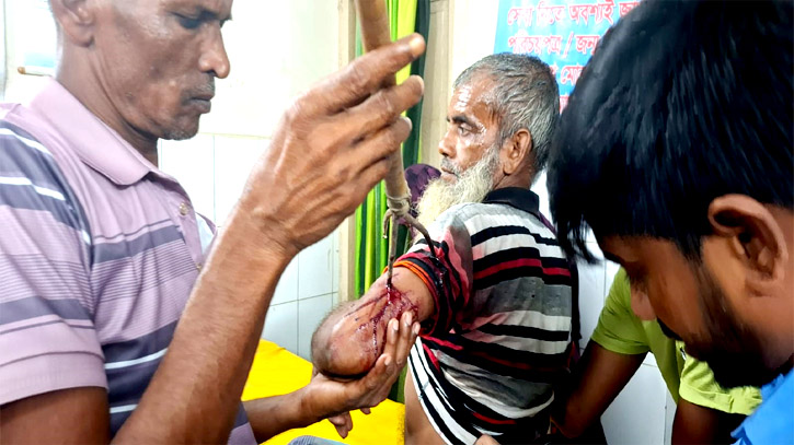 আড়াইহাজারে তিনদল গ্রামবাসীর মধ্যে সংষর্ষ, টেঁটাবিদ্ধ সহ আহত ২০