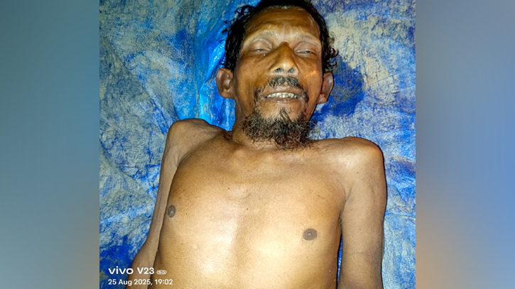 আড়াইহাজারে অজ্ঞাত লাশের পরিচয় মেলেনি আড়াইহাজারে অজ্ঞাত লাশের পরিচয় মেলেনি