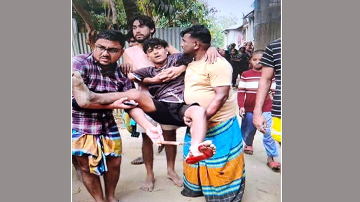 আড়াইহাজারে দুই পক্ষের সংঘর্ষে টেটাবিদ্ধসহ আহত ১০